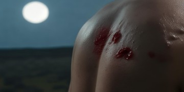 男友背上痘痘意味着什么？